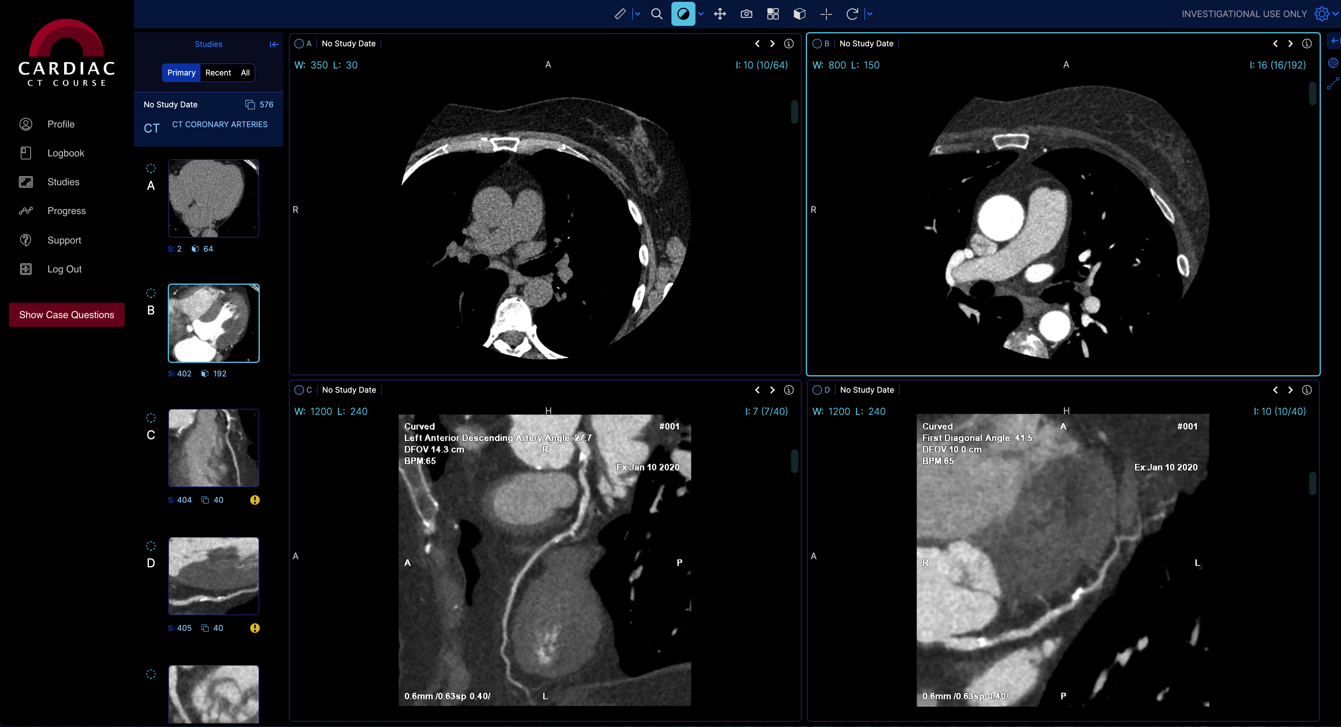 Main study viewer in The Cardiac CT Course software. A DICOM viewer shows 4 views of a Cardiac CT scan.